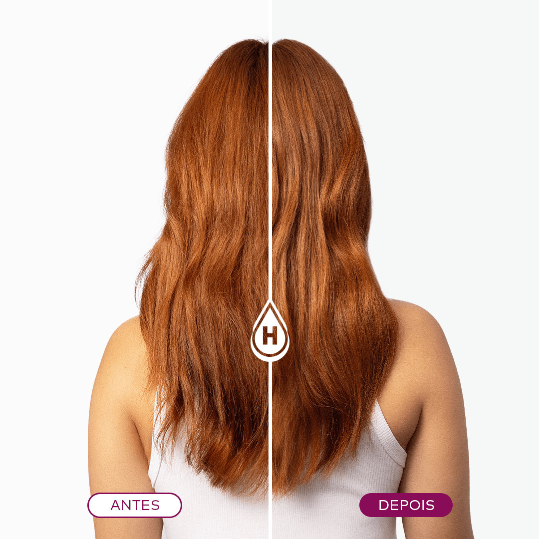 Linha Completa Reconstrução