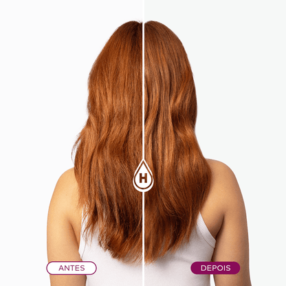 Linha Completa Reconstrução