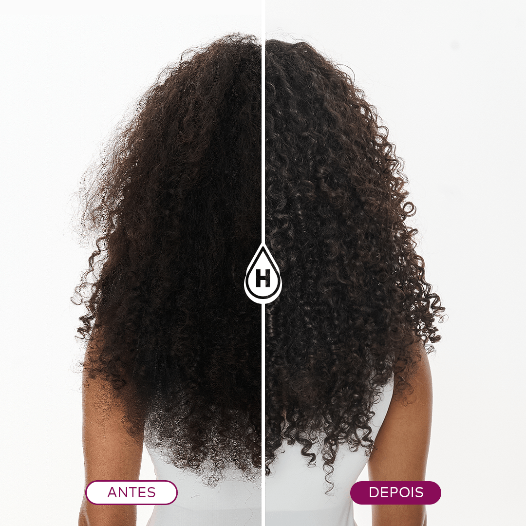 Linha Completa Reconstrução