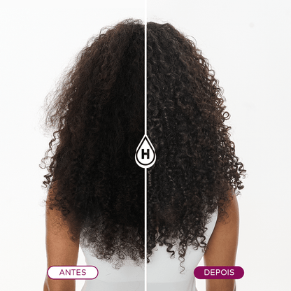 Linha Completa Reconstrução